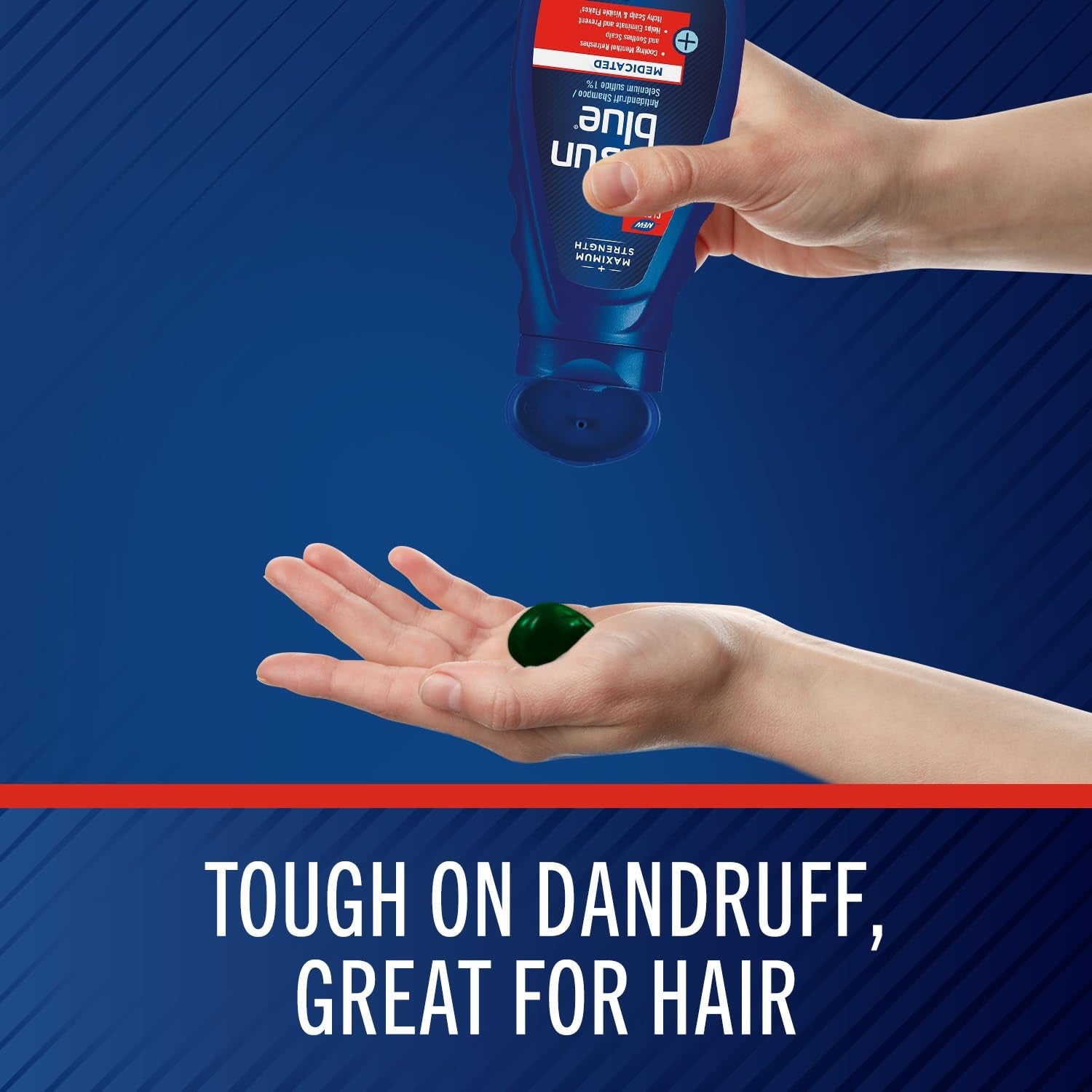 Selsun Blue Medicated Anti-Dandruff Shampoo with Menthol, 11 Fl. Oz., Maximum Strength, Selenium Sulfide 1%