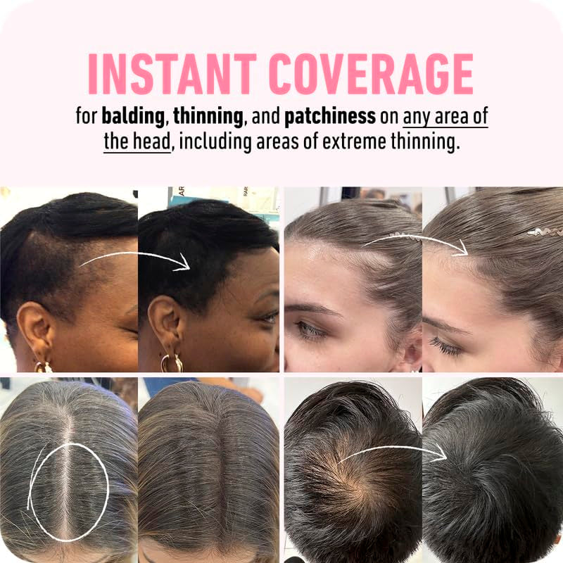 BOLDIFY Hairline Powder - Root Touch up & Hair Loss Cover Up, Instant Gray Coverage 48-Hour Stain-Proof Hair Color Powder for Women & Men, Hair Fibers and Hair Topper Alternative (Dark Brown)
