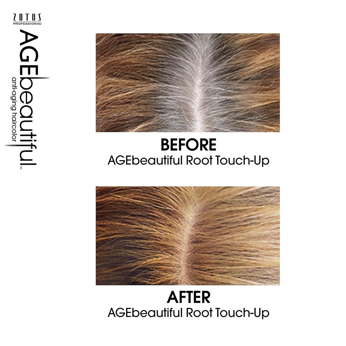 AGE Beautiful Root Touch up Hair Color Spray | Touch-Up Gray Concealer | Temporary Cover up | Adds Volume & Covers Thinning Patches | Water, Sweat, Stain Resistant