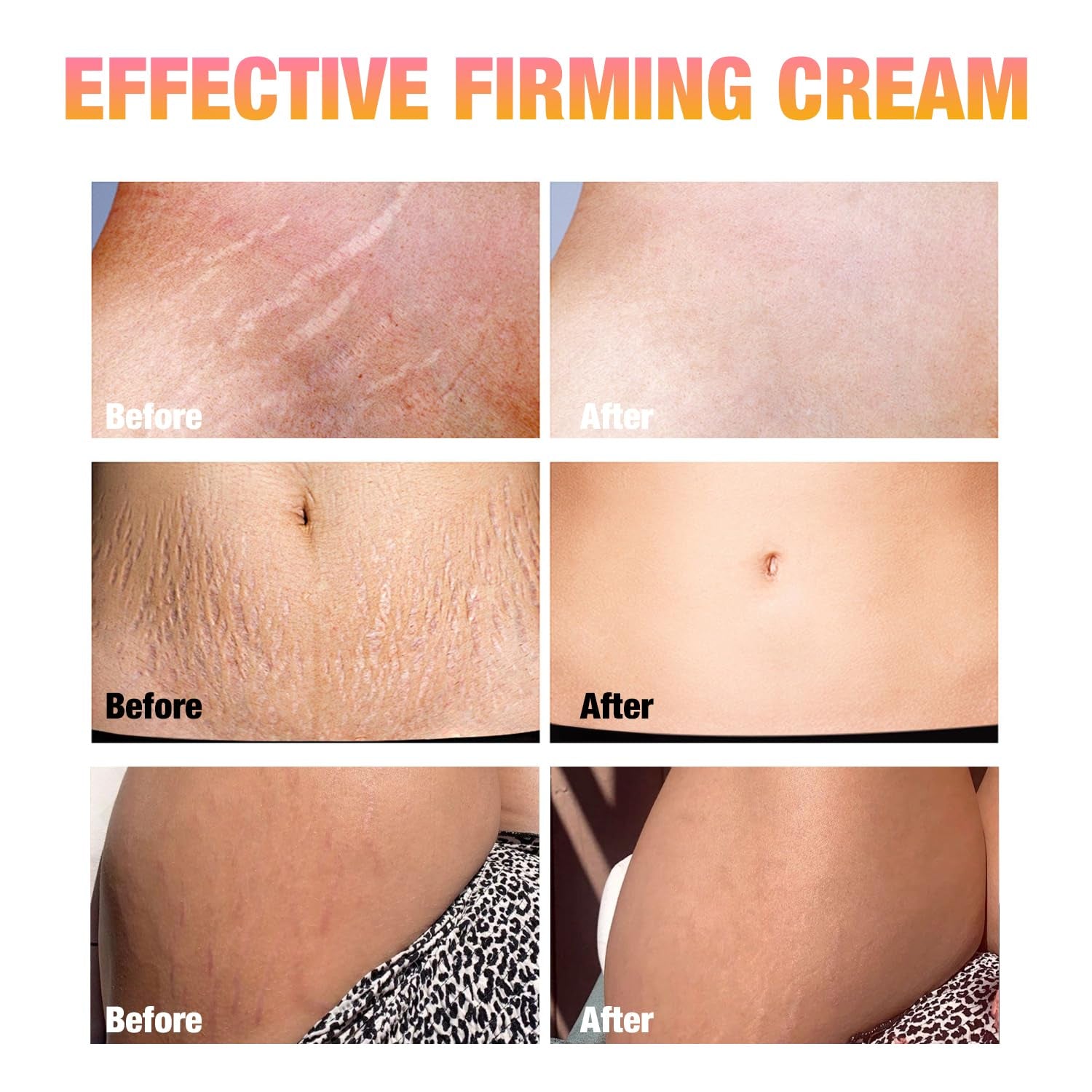 B Flat Belly Firming Cream - Skin Firming and Tightening for Tummy, Thighs, Arms, Butt - Stretch Mark & Cellulite Moisturizing Stomach Body Lotion for Women - 3.38 Fl Oz